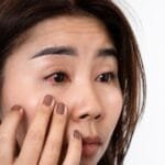 Visual guide detailing common causes, signs, and relief strategies for dry eye to enhance awareness and treatment options.