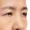 Droopy Eyes