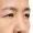 Droopy Eyes
